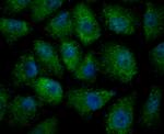 ULK1 Antibody in Immunocytochemistry (ICC/IF)