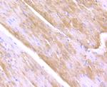 ULK1 Antibody in Immunohistochemistry (Paraffin) (IHC (P))