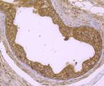 DDIT4 Antibody in Immunohistochemistry (Paraffin) (IHC (P))