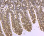 DDIT4 Antibody in Immunohistochemistry (Paraffin) (IHC (P))