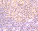 DDIT4 Antibody in Immunohistochemistry (Paraffin) (IHC (P))