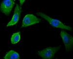 PSMA Antibody in Immunocytochemistry (ICC/IF)