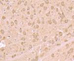 TSPO Antibody in Immunohistochemistry (Paraffin) (IHC (P))