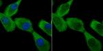 ATG7 Antibody in Immunocytochemistry (ICC/IF)