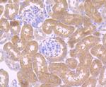 ATG7 Antibody in Immunohistochemistry (Paraffin) (IHC (P))