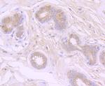 ATG7 Antibody in Immunohistochemistry (Paraffin) (IHC (P))