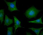 LC3A/LC3B Antibody in Immunocytochemistry (ICC/IF)