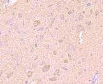 LC3A/LC3B Antibody in Immunohistochemistry (Paraffin) (IHC (P))