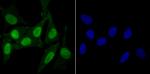 KDM5B Antibody in Immunocytochemistry (ICC/IF)