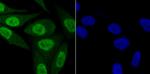 KDM5B Antibody in Immunocytochemistry (ICC/IF)