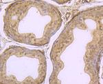 KDM5B Antibody in Immunohistochemistry (Paraffin) (IHC (P))