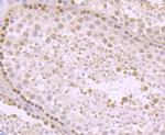 KDM5B Antibody in Immunohistochemistry (Paraffin) (IHC (P))