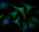 USP21 Antibody in Immunocytochemistry (ICC/IF)