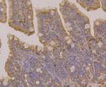 RAB7A Antibody in Immunohistochemistry (Paraffin) (IHC (P))