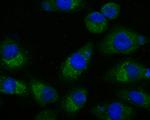 SUFU Antibody in Immunocytochemistry (ICC/IF)