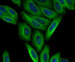 CTGF Antibody in Immunocytochemistry (ICC/IF)