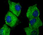 CTGF Antibody in Immunocytochemistry (ICC/IF)