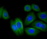 CTGF Antibody in Immunocytochemistry (ICC/IF)