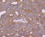 CTGF Antibody in Immunohistochemistry (Paraffin) (IHC (P))