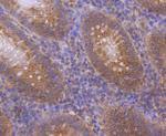 CTGF Antibody in Immunohistochemistry (Paraffin) (IHC (P))