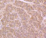 Butyrylcholinesterase Antibody in Immunohistochemistry (Paraffin) (IHC (P))