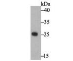 Staphylococcus Enterotoxin A Antibody in Western Blot (WB)