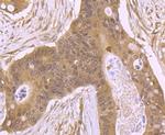 ROC1 Antibody in Immunohistochemistry (Paraffin) (IHC (P))