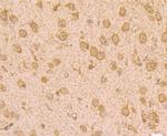 UAP1 Antibody in Immunohistochemistry (Paraffin) (IHC (P))