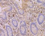 SERPINC1 Antibody in Immunohistochemistry (Paraffin) (IHC (P))