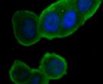 ORAI1 Antibody in Immunocytochemistry (ICC/IF)