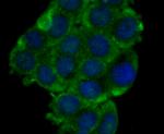 ORAI1 Antibody in Immunocytochemistry (ICC/IF)