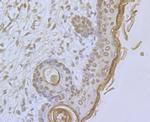 ORAI1 Antibody in Immunohistochemistry (Paraffin) (IHC (P))