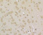 NDUFS3 Antibody in Immunohistochemistry (Paraffin) (IHC (P))