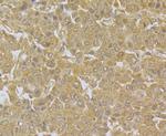 NDUFS3 Antibody in Immunohistochemistry (Paraffin) (IHC (P))