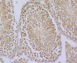 GPX4 Antibody in Immunohistochemistry (Paraffin) (IHC (P))