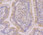 N-WASP Antibody in Immunohistochemistry (Paraffin) (IHC (P))