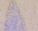 RyR1 Antibody in Immunohistochemistry (Paraffin) (IHC (P))