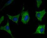 Ryanodine Receptor Antibody in Immunocytochemistry (ICC/IF)