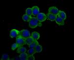 Ryanodine Receptor Antibody in Immunocytochemistry (ICC/IF)