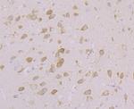 CACNB3 Antibody in Immunohistochemistry (Paraffin) (IHC (P))