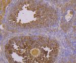 CACNB3 Antibody in Immunohistochemistry (Paraffin) (IHC (P))