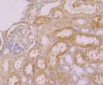 KIF11 Antibody in Immunohistochemistry (Paraffin) (IHC (P))