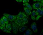 CACNG5 Antibody in Immunocytochemistry (ICC/IF)