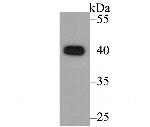 CACNG5 Antibody in Western Blot (WB)