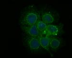 PHF8 Antibody in Immunocytochemistry (ICC/IF)