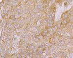 PHF8 Antibody in Immunohistochemistry (Paraffin) (IHC (P))