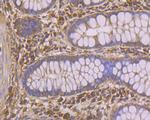 PHF8 Antibody in Immunohistochemistry (Paraffin) (IHC (P))