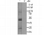 CACNG3 Antibody in Western Blot (WB)