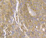 MCU Antibody in Immunohistochemistry (Paraffin) (IHC (P))