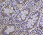 MCU Antibody in Immunohistochemistry (Paraffin) (IHC (P))